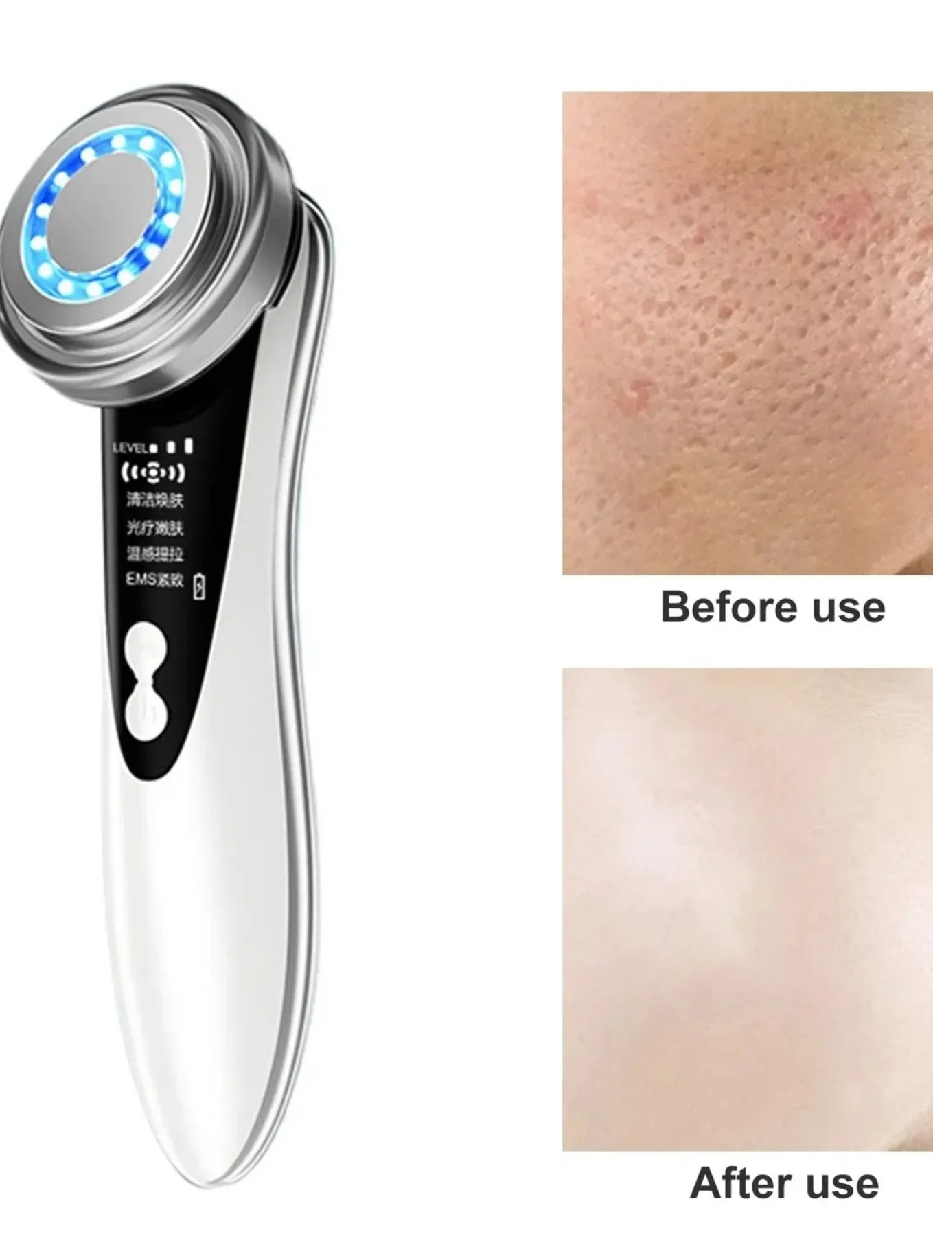 5-In-1 Facial Massager