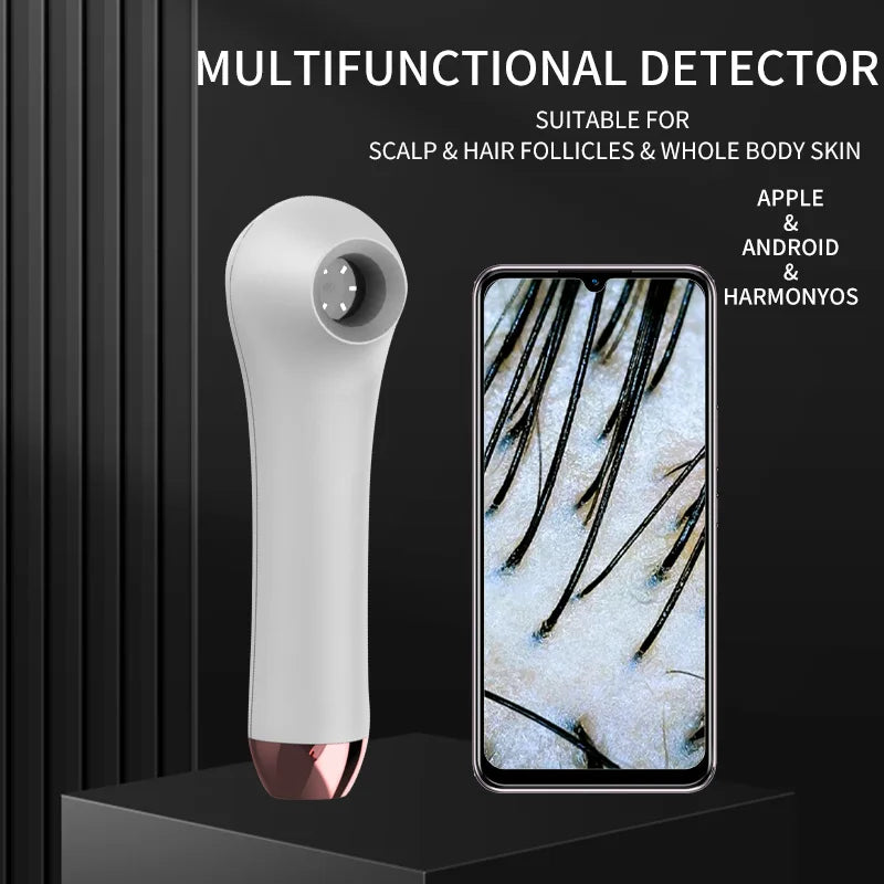 2025 HD Skin & Scalp Analyzer – Hair Follicle Detector with APP View (Non-Rechargeable)